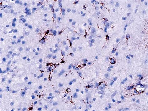 Glial fibrillary acidic protein